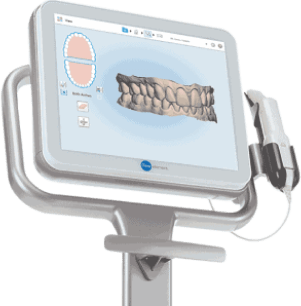 3d digital scan and smile simulation
