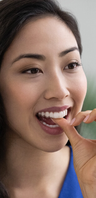 Invisalign banner 4