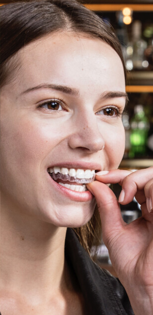 Invisalign banner 5